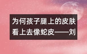 為何孩子腿上的皮膚看上去像蛇皮――劉健航回答