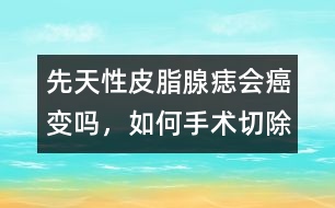 先天性皮脂腺痣會癌變嗎，如何手術(shù)切除