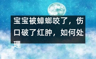 寶寶被蟑螂咬了，傷口破了紅腫，如何處理