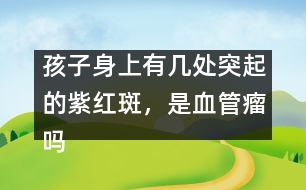 孩子身上有幾處突起的紫紅斑，是血管瘤嗎