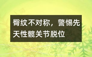 臀紋不對稱，警惕先天性髖關(guān)節(jié)脫位