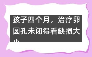 孩子四個(gè)月，治療卵圓孔未閉得看缺損大小