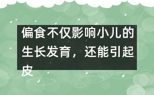 偏食不僅影響小兒的生長發(fā)育，還能引起皮膚病